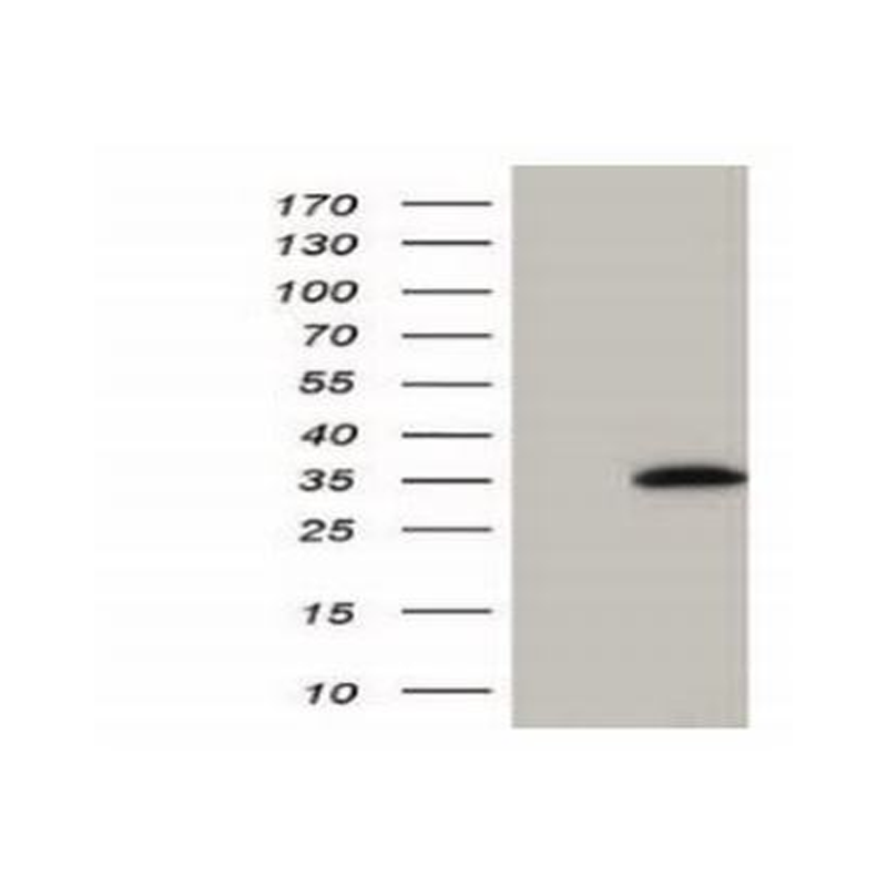 TA-04-0.1ml 小鼠抗HA单抗 - ZSGB-BIO/中杉金桥