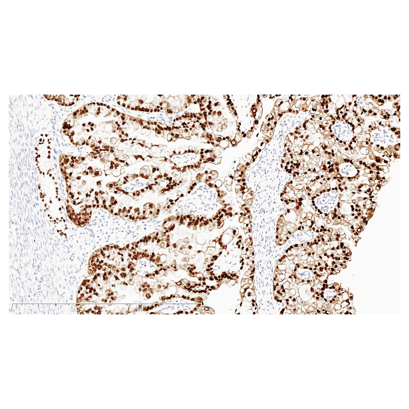 ZA-0129-6 HNF1 β兔抗人HNF1β多克隆抗体 - ZSGB-BIO/中杉金桥