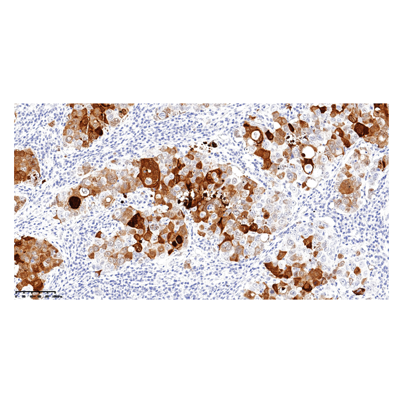 ZA-0552-3ml HIF-1α抗体试剂（免疫组织化学） - ZSGB-BIO/中杉金桥