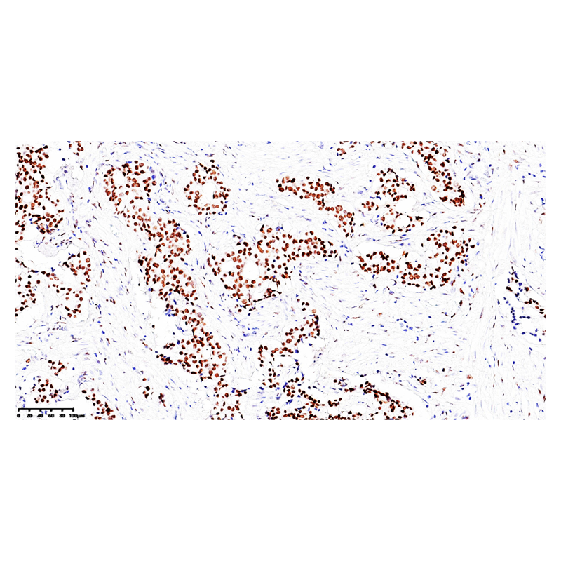 ZA-0554 -3ml AR(AndrogenReceptor)雄激素受体 - ZSGB-BIO/中杉金桥