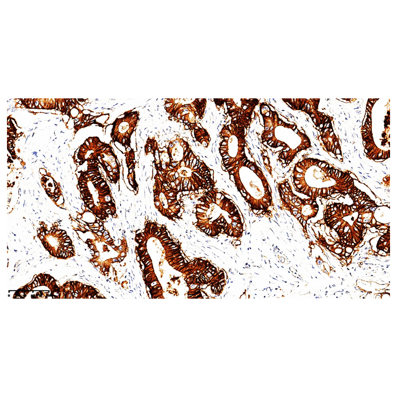 ZA-0630-0.2ml 钙黏附蛋白17 Cadherin - ZSGB-BIO/中杉金桥